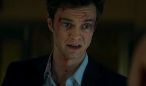 &ldquo;NOVOCAINE SIN DOLOR&rdquo; irrumpe en cines dominicanos